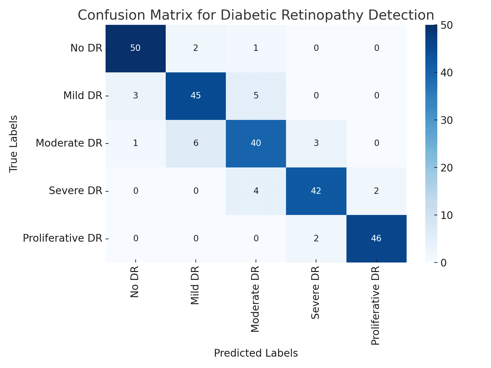 Matriz de Confusión para la Detección de Retinopatía Diabética